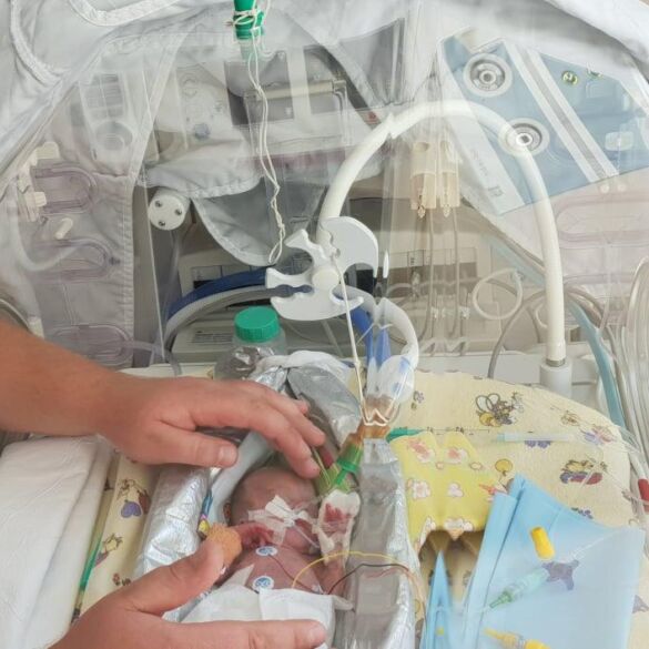 Mažiausia Lietuvoje gimusi mergaitė kiekvieną dieną kaunasi už gyvenimą: „Ji buvo tokio didumo