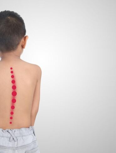 Santaros klinikose dvylikamečiui pacientui iškrypęs stuburas tiesintas nauju metodu
