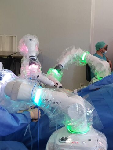 Santaros klinikose prasideda robotinės chirurgijos era: preciziškas tikslumas