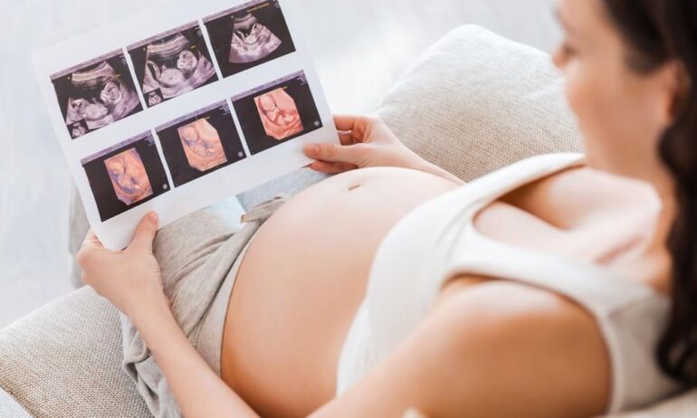 Trynukų besilaukiančią moterį diagnozė pribloškė