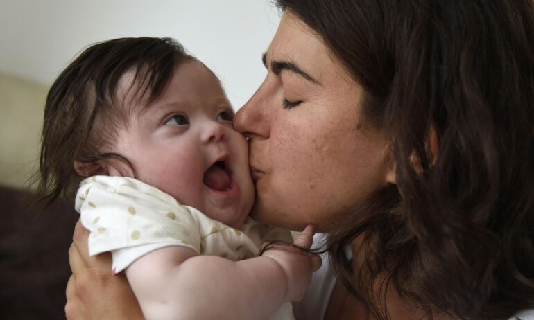 Vaiką su Dauno sindromu auginančios mamos atviras laiškas mums visiems