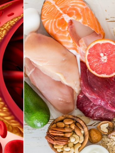 Žiemą nepelnytai pamirštama maisto sudėtinė dalis: gelbsti virškinimui ir reguliuoja cholesterolį