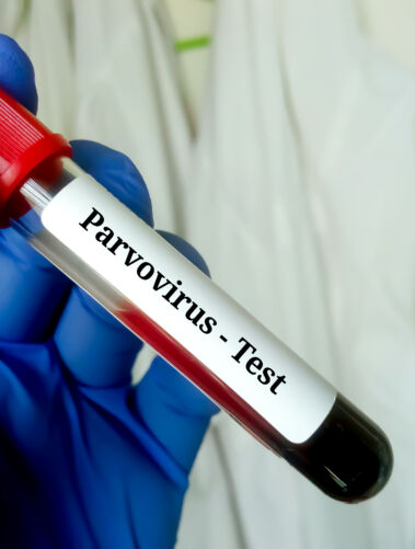 Parvo virusas