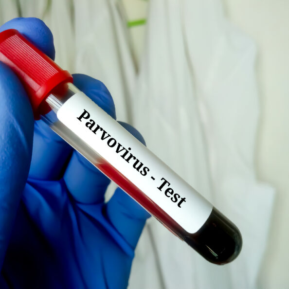 Parvo virusas