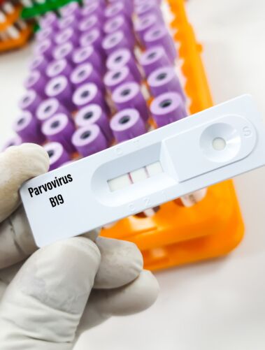 Parvo virusas