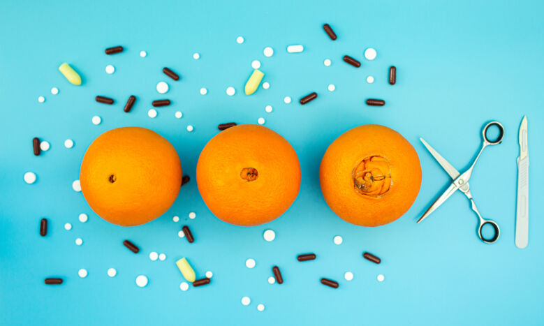 Hemorojus / Shutterstock