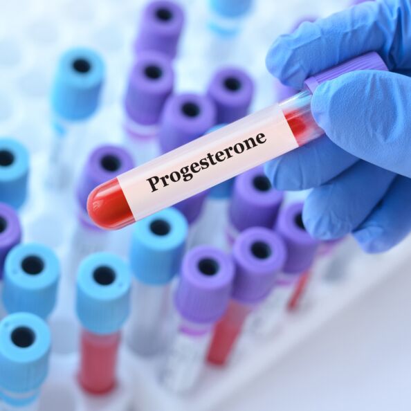 Progesteronas / Shutterstock