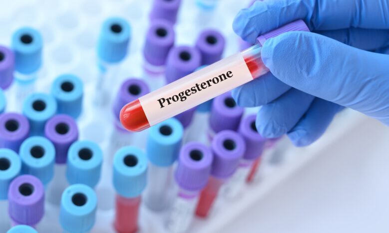 Progesteronas / Shutterstock