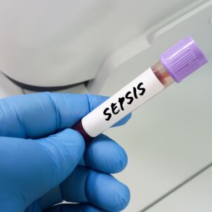 Sepsis / Shutterstock