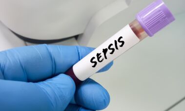 Sepsis / Shutterstock