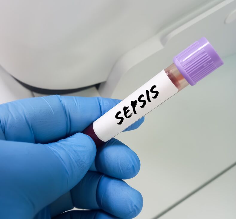 Sepsis / Shutterstock