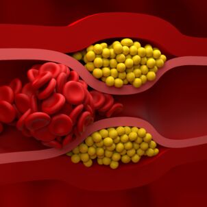 Cholesterolis / Shutterstock