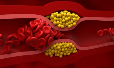 Cholesterolis / Shutterstock